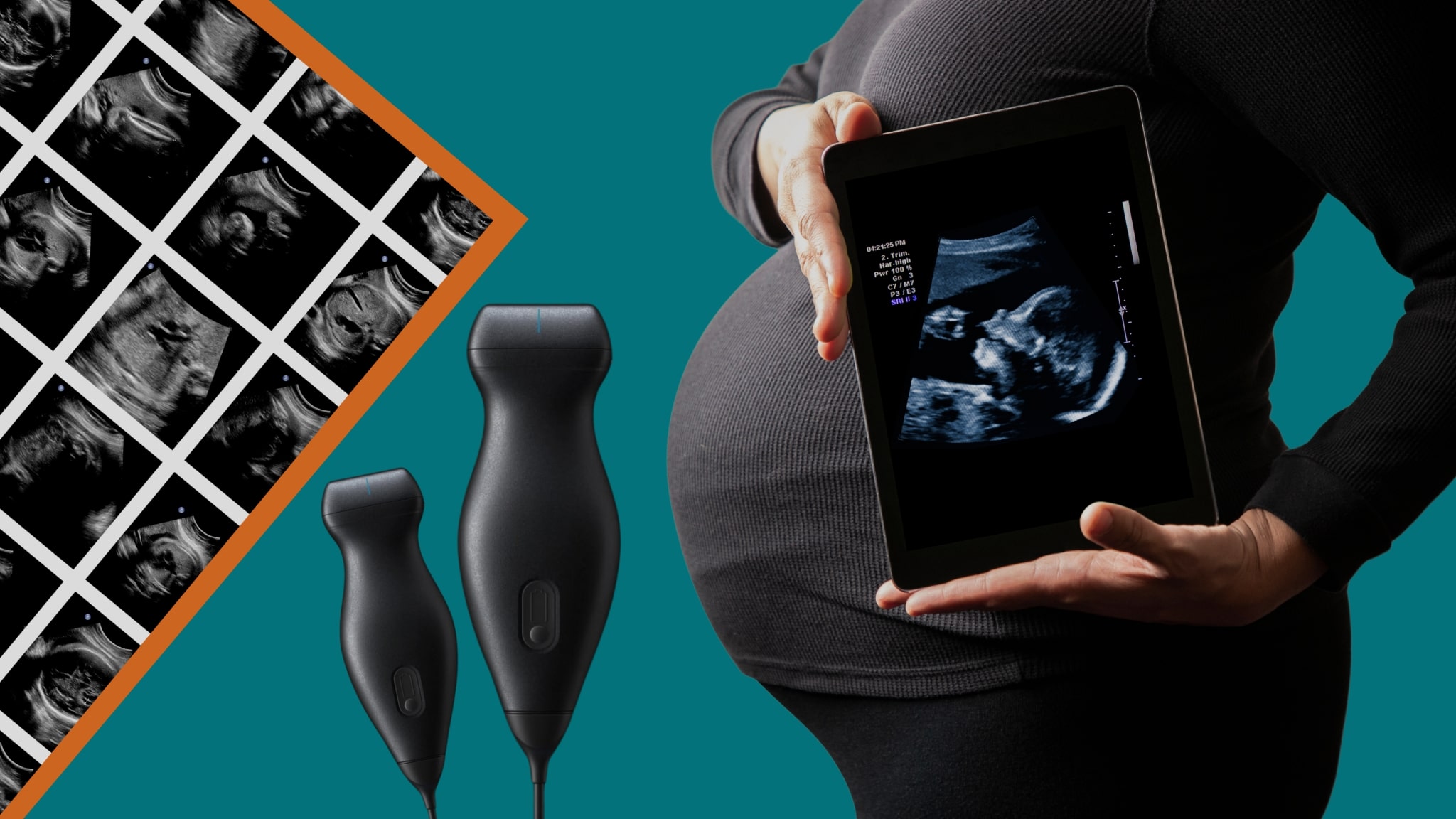 GUSI Global Ultrasound Institute POCUS Undergraduate Progams Image 2 2048x1152 1